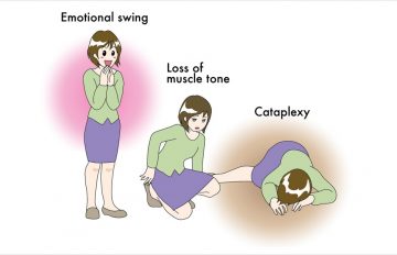 کاتاپلکسی (Cataplexy) چیست؛ علل، علائم و درمان