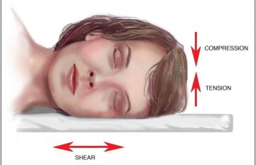 روش درست خوابیدن برای جلوگیری از چروک صورت