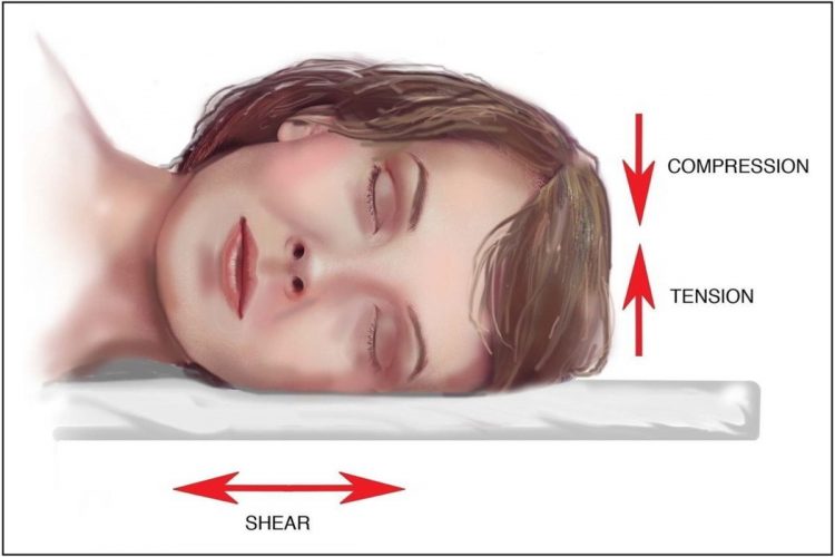 روش درست خوابیدن برای جلوگیری از چروک صورت
