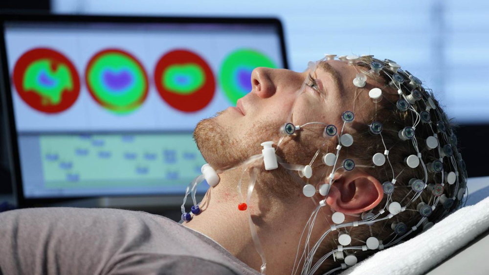  EEG 